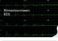 Pathofysiologie- Oefeningen ECG ( 2022-2023)