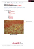 BIO 202L Lab 18 Worksheet- The Reproductive System Course BIO 202L Institution Straighterline BIO 202L Lab 18 Worksheet- The Reproductive System/BIO 202L Lab 18 Worksheet- The Reproductive System