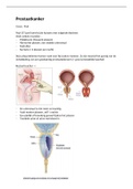 Prostaatcarcinoom