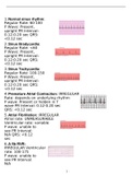 Prophecy EKG Questions And Answers 2023/2024