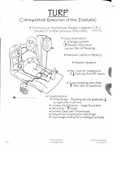 Transurethral Resection of the Prostate