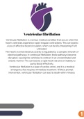 Ventricular fibrillation nclex