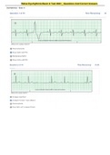 Relias Dysrhythmia Basic A Test 2023 _ Questions And Correct Answers