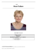 UNFOLDING Reasoning Case Study: Heart Failure, JoAnn Smith, 72 years old, (Latest 2021) 100% Correct Study Guide, Download to Score A