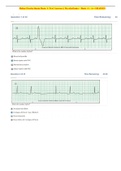 Relias Dysrhythmia Basic A Test Answers | Dysrhythmia – Basic A ( A+ GRADED