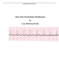 Basic EKG Dysrhythmia Identification by JLix MSN/Ed, RN-BC