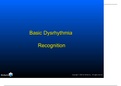 basic dysrhythmia recognition Questions with correct answers