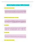 ACLS rhythm strips 100% Correct