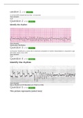 EKG Clep Test