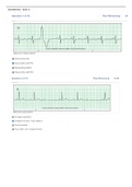 Relias Dysrhythmia Basic Test Answers 2023/2024 Dysrhythmia – Basic A ( A+ GRADED 100% VERIFIED)