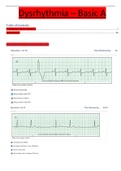 Relias Dysrhythmia Basic Test Answered 100% 2023 Dysrhythmia – Basic A (Guarantee A+ SCORE|VERIFIED)