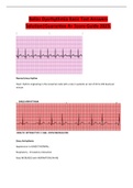 Relias Dysrhythmia Basic Test Answers Solution|Guarantee A+ Score Guide 2023.