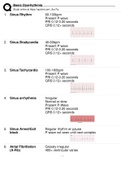 Basic Dysrhythmia questions and answers