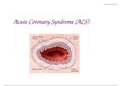 NR 500 NP Acute Coronary Syndrome