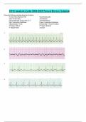 ECG Analysis (Acls) 2024-2025 Newest Review Solution 