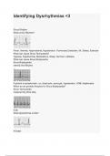 Identifying Dysrhythmias 3.