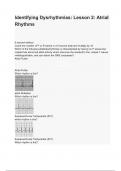 Identifying Dysrhythmias Lesson 2 Atrial Rhythms.