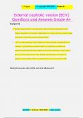 External cephalic version (ECV) Questions and Answers Grade A+