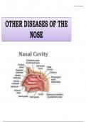 OTHER DISEASES OF THE  NOSE Nasal Polyps